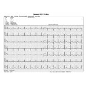 Rapport ECG Edan