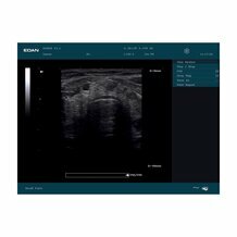 Echographe portable Edan DUS60 avec 2 sonde