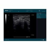 Echographe portable Edan DUS60